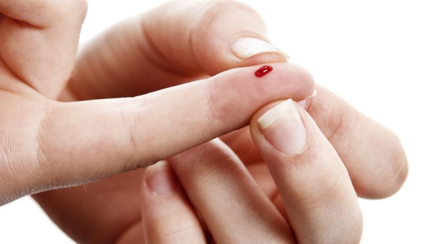 ujjbegyből vett vérből mutatja ki a fertőzést a teszt
