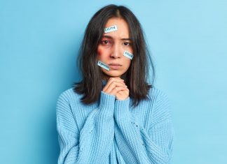 Hová fordulhatunk segítségért ha bántalmaznak? Női áldozat